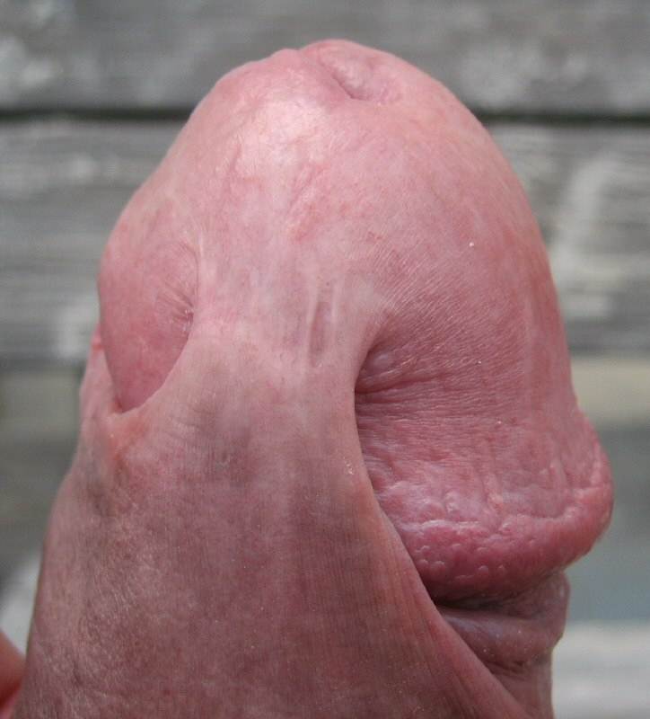 Penis For Skin 112