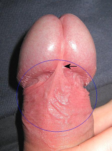 Ventral penis showing the frenular delta from the glans to the ridged band
