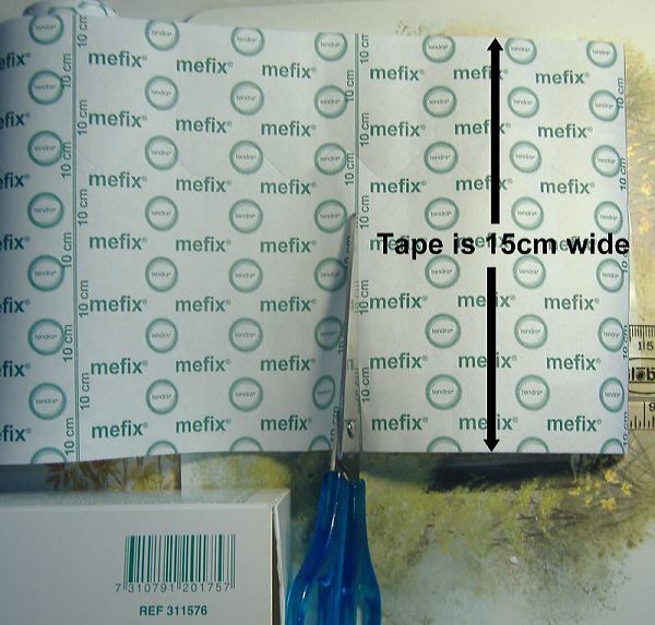 Foreskin restoraton t-taping tape cut Mefix tape cutting