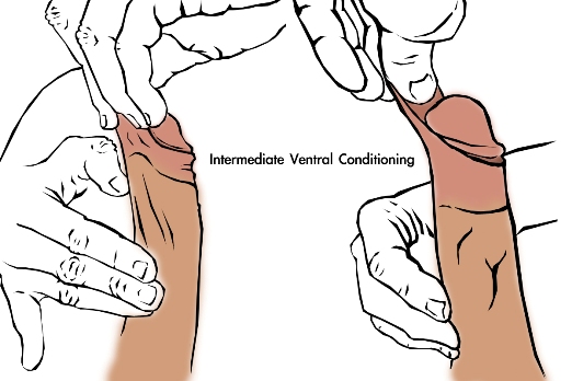 Method 1 manual tugging for stretching/tensioning the ventral - bottom side of the penis foreskin