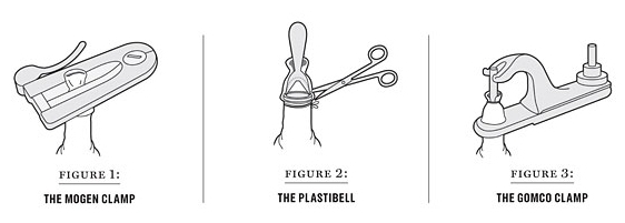 Common Circumcision Devices