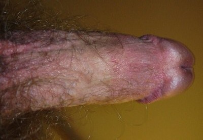Penis with Hairy Shaft
